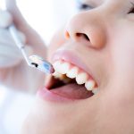 Plaque vs. Tartar Differences and Prevention Tips